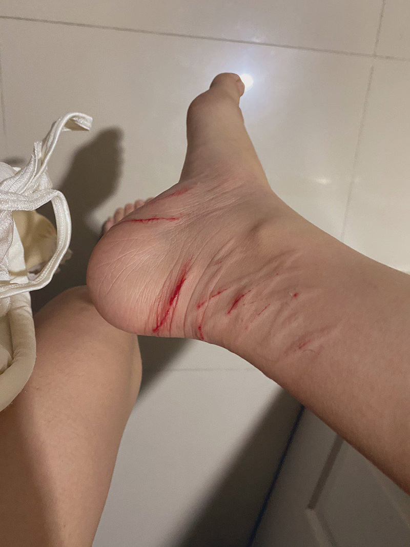 อุทาหรณ์คนเลี้ยงแมว ! 