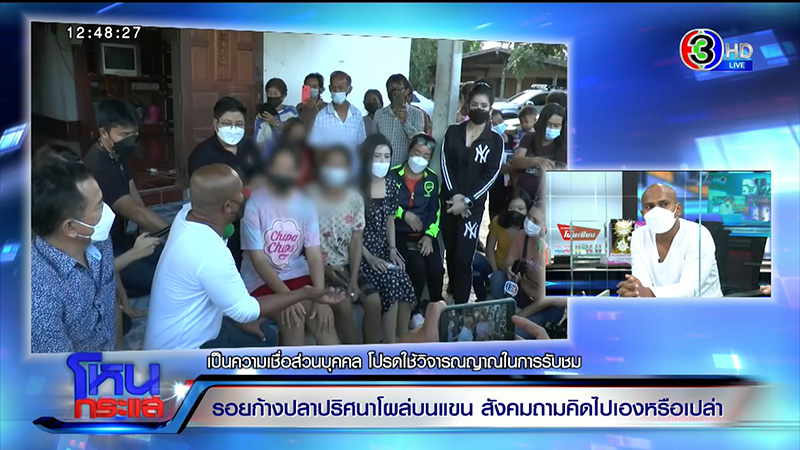 รอยก้างปลาปริศนาโผล่ที่แขน ด.ญ. วัย 13