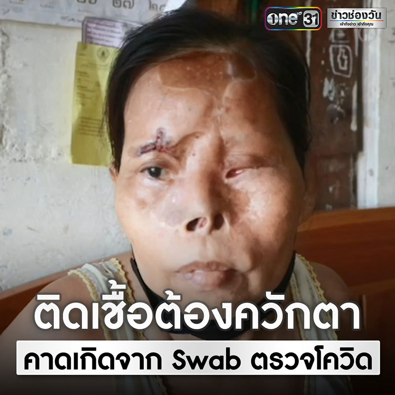 ยายวัย 60 ร้องสื่อ หกล้มขาหัก แต่ติดเชื้อจนตาบอด