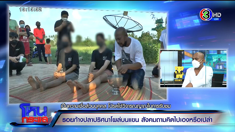 รอยก้างปลาปริศนาโผล่ที่แขน ด.ญ. วัย 13