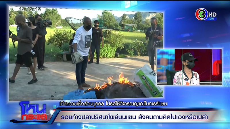 รอยก้างปลาปริศนาโผล่ที่แขน ด.ญ. วัย 13