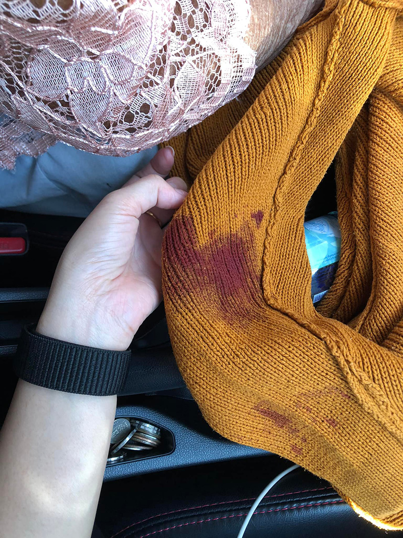 หลานทนมา 2 ปี ยายเจอพยาบาลด่า ล่าสุดเลือดไหลไม่หยุด