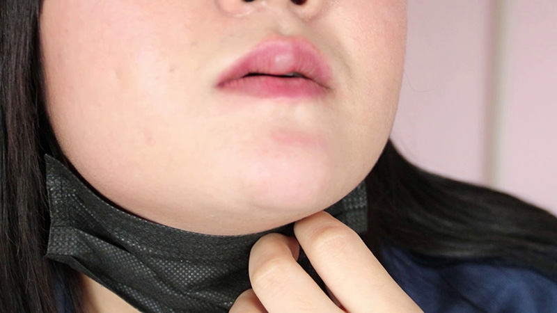 สาวร้องคลินิกศัลยกรรม