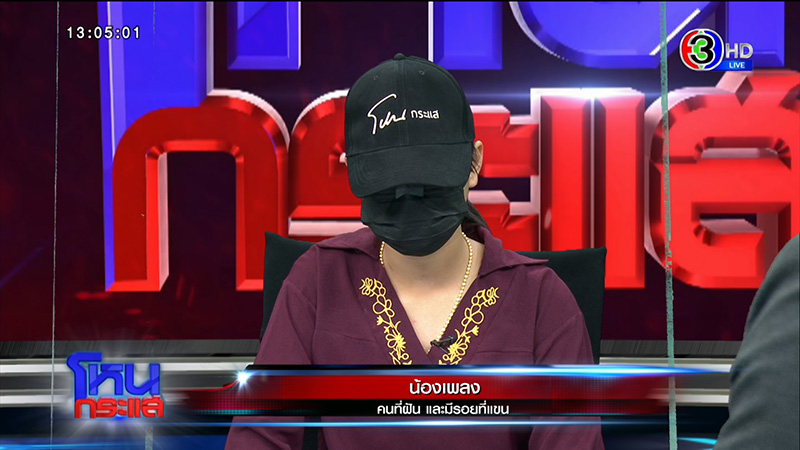 รอยก้างปลาปริศนาโผล่ที่แขน ด.ญ. วัย 13