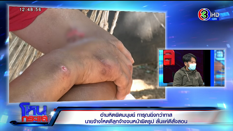 น้องฟ้า ถูกทารุณโหด