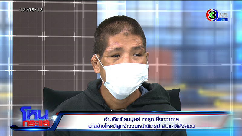 น้องฟ้า ถูกทารุณโหด