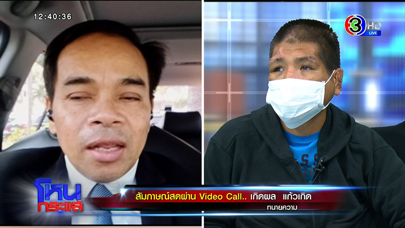 หมอศัลย์ช่วย ฟ้า เหยื่อนายจ้าง