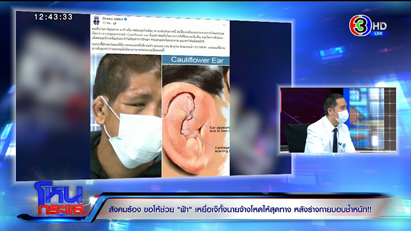 หมอศัลย์ช่วย ฟ้า เหยื่อนายจ้าง