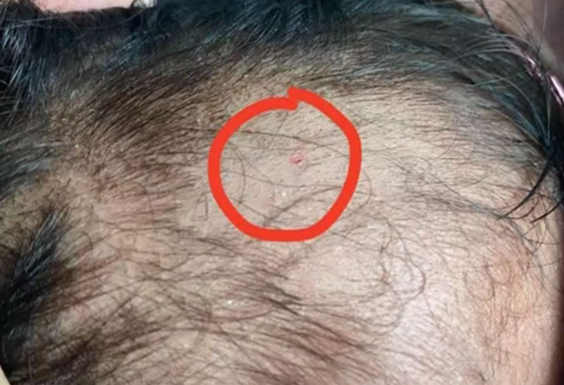 งูเห่าซุกใต้ผ้าห่ม เด็กน้อย 2 ขวบ