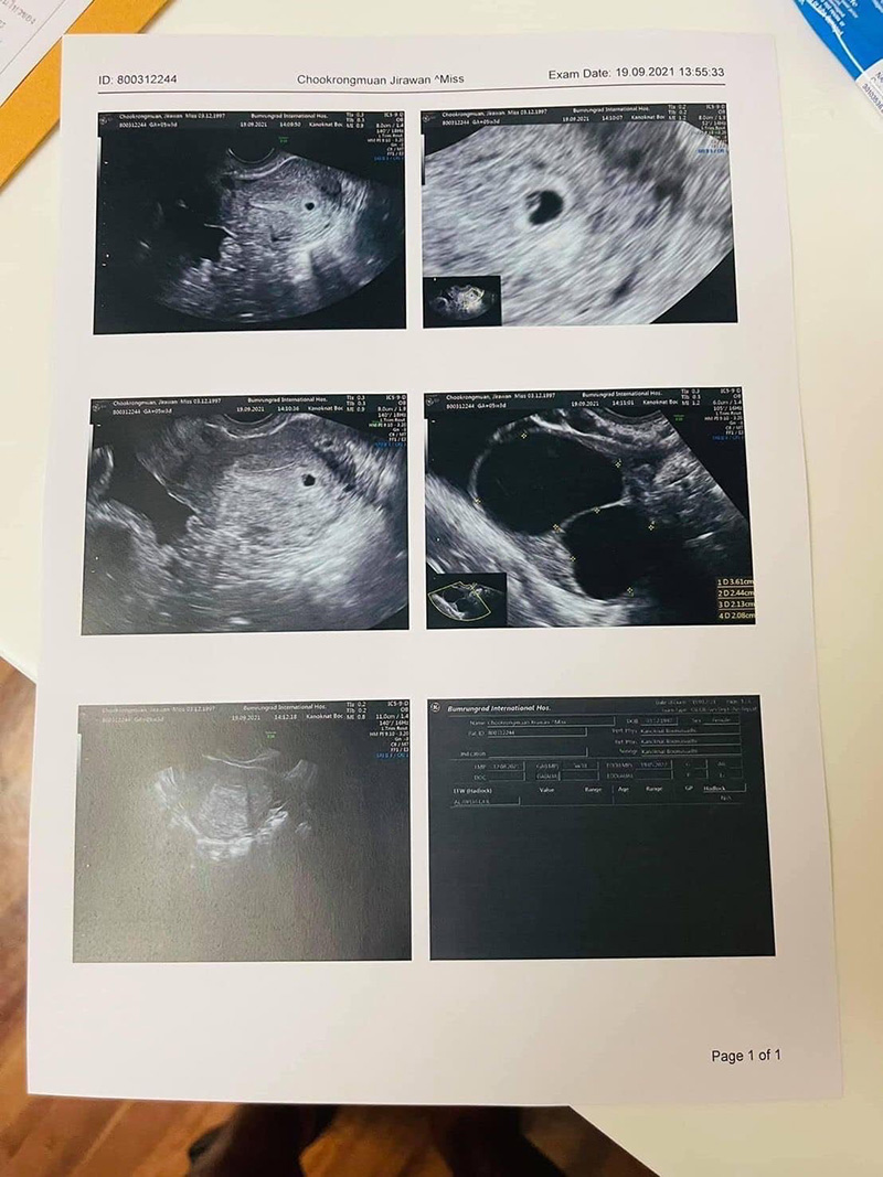 เก่ง ลายพราง ประกาศข่าวดีแฟนสาวท้องแล้ว