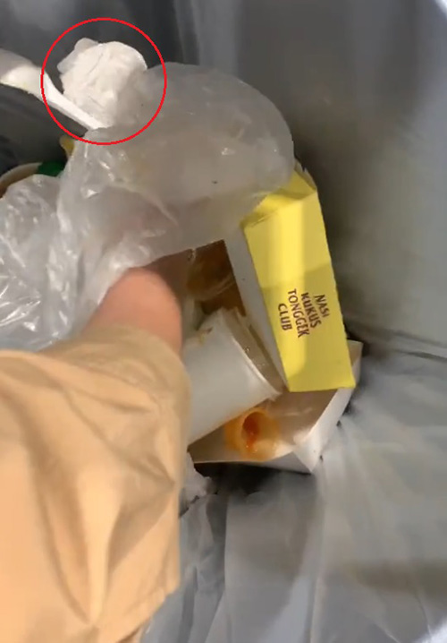 สาวเหงื่อตก ทำรีเทนเนอร์หาย