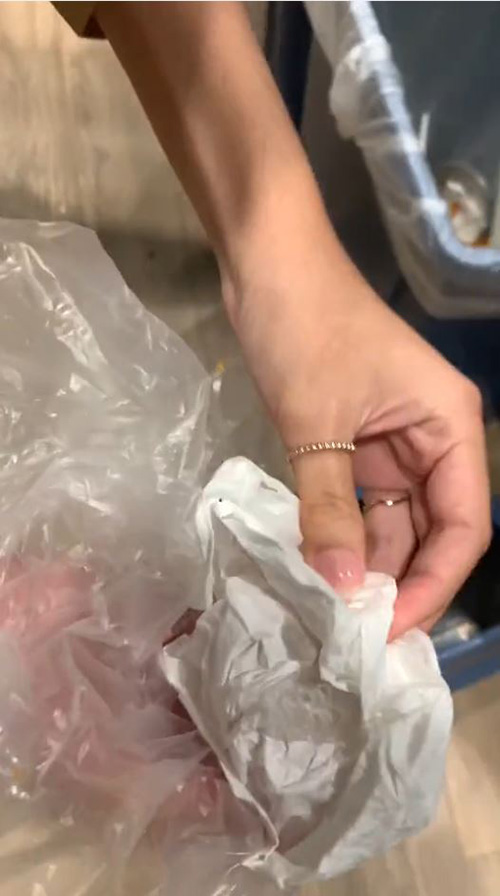 สาวเหงื่อตก ทำรีเทนเนอร์หาย