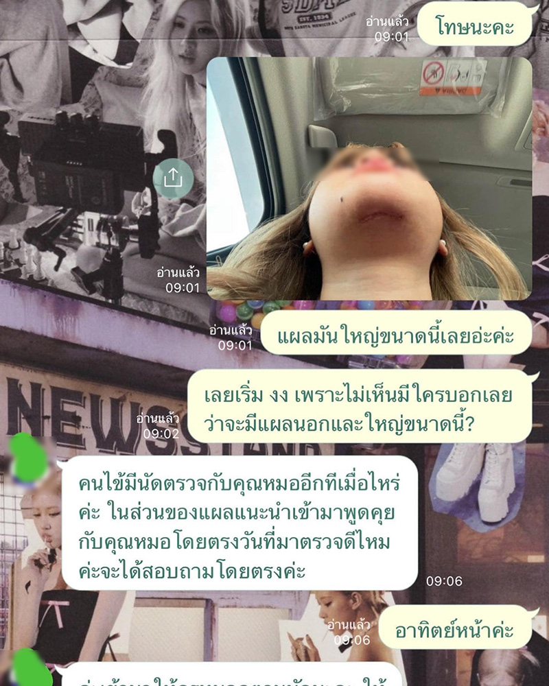 สาวทำคางวีไลน์ 2 แสน ผลออกมาคือตราบาป 