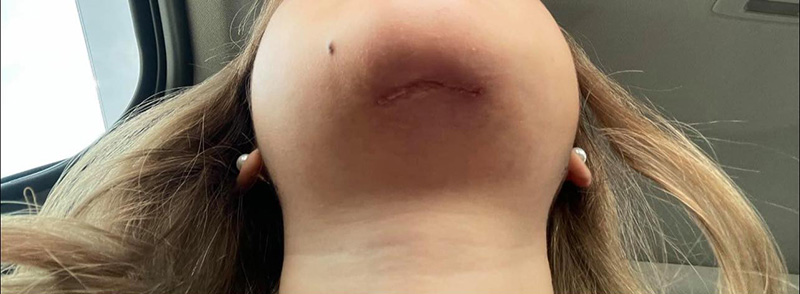 สาวทำคางวีไลน์ 2 แสน ผลออกมาคือตราบาป 