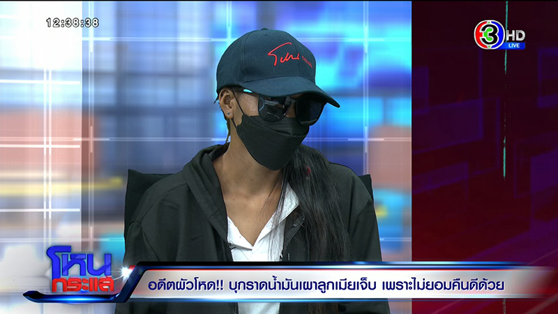 หญิงถูกสามีจุดไฟเผาต่อหน้าลูก เจ็บแต่ยังให้โอกาสคืนดี