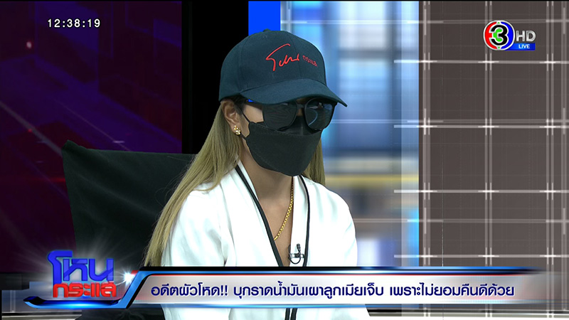 หญิงถูกสามีจุดไฟเผาต่อหน้าลูก เจ็บแต่ยังให้โอกาสคืนดี