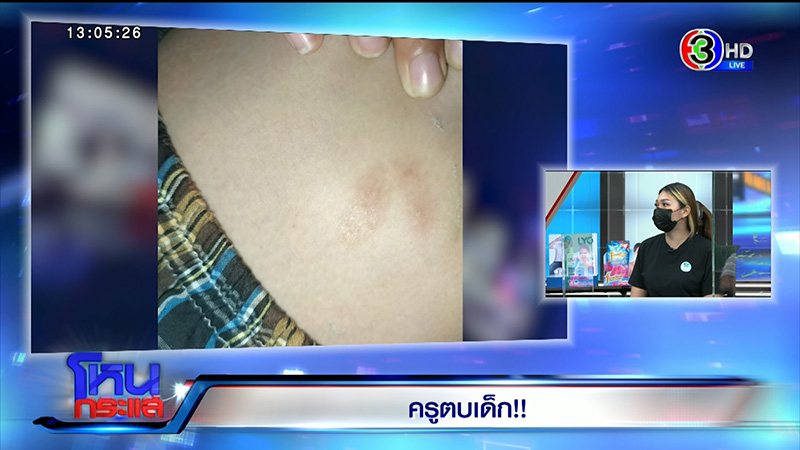 ดราม่าเดือด ! ครูทำร้าย นร.