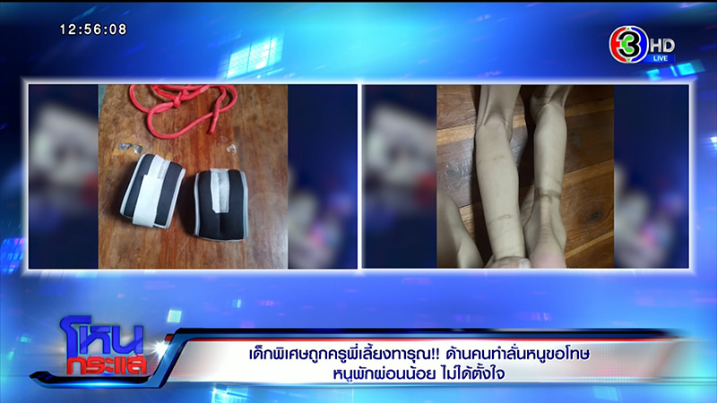 เด็กพิเศษถูกครูทารุณจับผูกขา