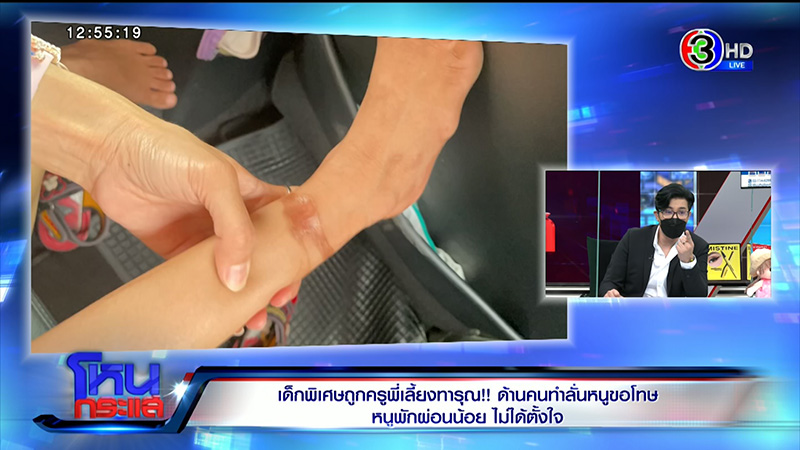 เด็กพิเศษถูกครูทารุณจับผูกขา