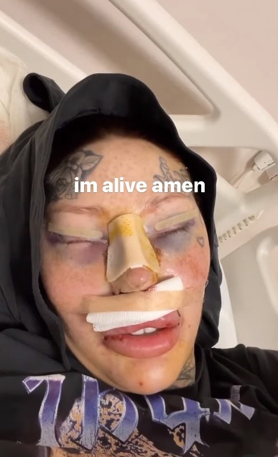 สาวคลั่งศัลย์ อวดผลงานล่าสุด