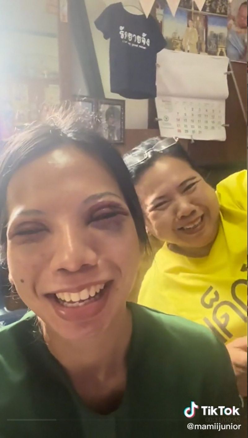 ไวรัล แม่เป็นห่วงลูก เมื่อลูกไปทำตา 