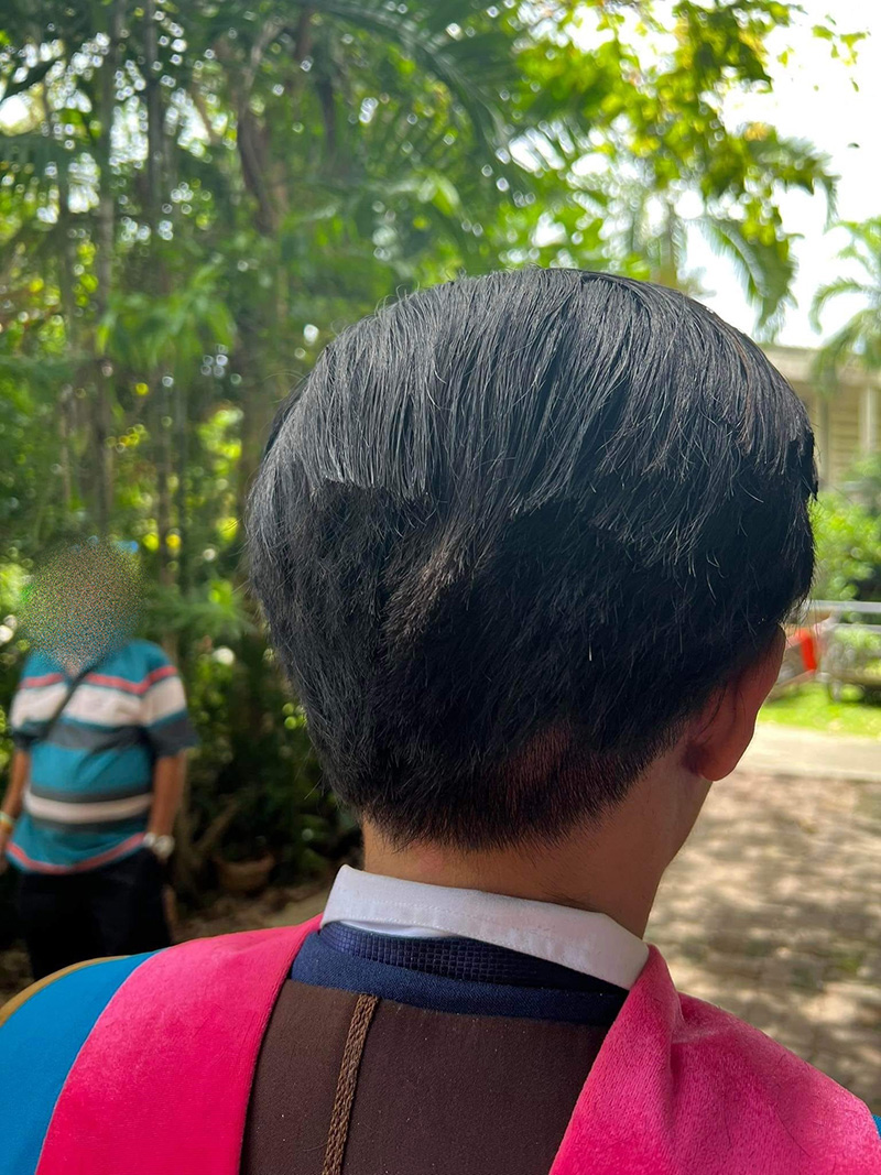 บัณฑิตเล่าตอนถูกตัดผมแหว่งเหมือนหนูแทะ