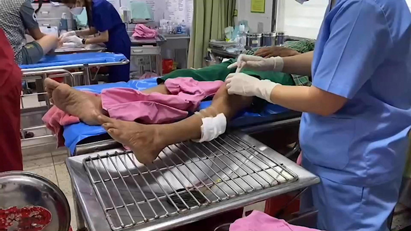 ยายเล่านาทีหวิดดับ งมกุ้งในคลองอยู่ดี ๆ โดนจระเข้โผล่มากัด 