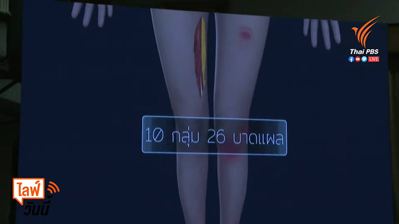 แผลแตงโม นิดา