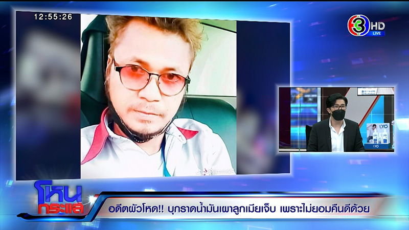 หญิงถูกสามีจุดไฟเผาต่อหน้าลูก เจ็บแต่ยังให้โอกาสคืนดี