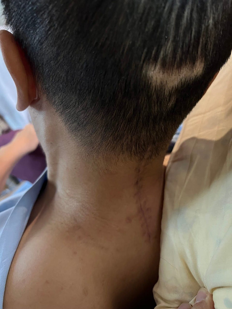 พ่อเฝ้าลูกเล่นเครื่องเล่น ก่อนชนคานเจ็บหนัก 