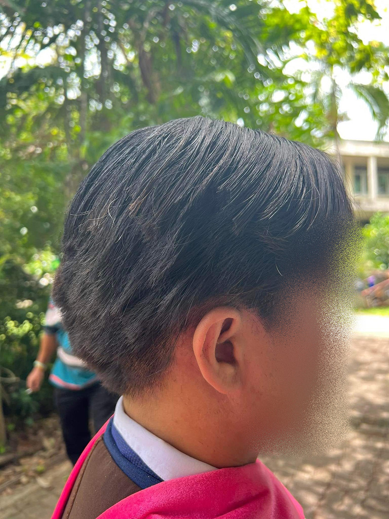 บัณฑิตเล่าตอนถูกตัดผมแหว่งเหมือนหนูแทะ