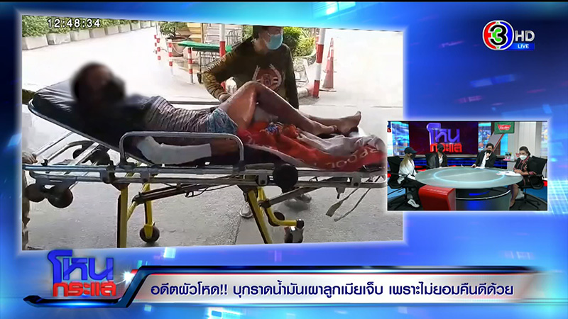 หญิงถูกสามีจุดไฟเผาต่อหน้าลูก เจ็บแต่ยังให้โอกาสคืนดี