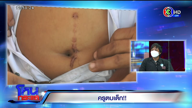 ดราม่าเดือด ! ครูทำร้าย นร.