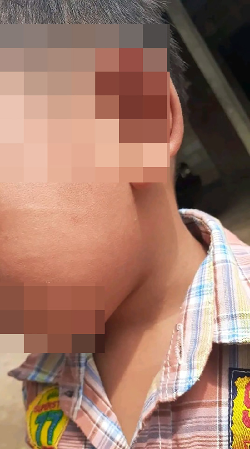 แม่โวย หมอตบหน้าลูกจนขึ้นรอย เหตุเด็กอุทานใส่หน้า