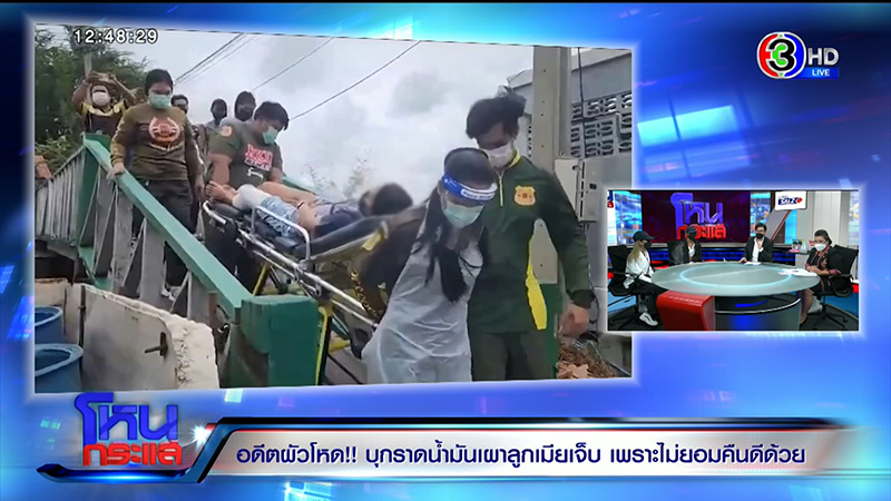 หญิงถูกสามีจุดไฟเผาต่อหน้าลูก เจ็บแต่ยังให้โอกาสคืนดี