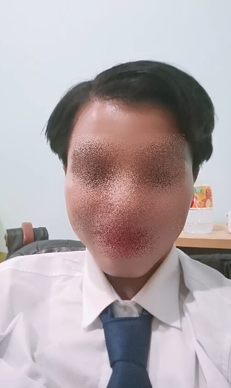 บัณฑิตเล่าตอนถูกตัดผมแหว่งเหมือนหนูแทะ