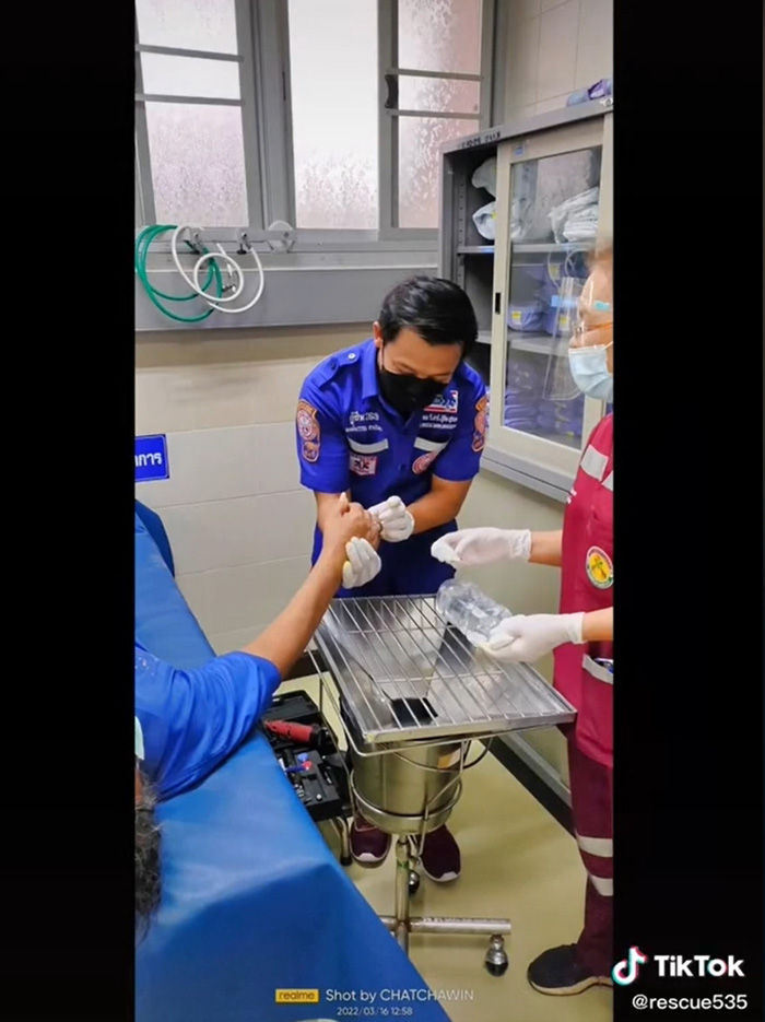 กู้ภัยเผยคลิปนาทีช่วยคนนิ้วกินแหวน