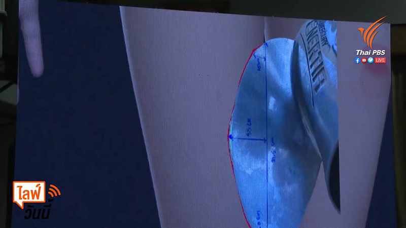 แผลแตงโม นิดา