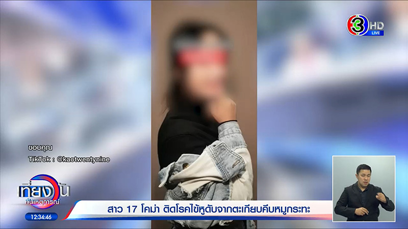 อุทาหรณ์สายปิ้งย่าง ใช้ตะเกียบคีบหมูกระทะ ป่วยไข้หูดับ เข้า ICU อาการโคม่า