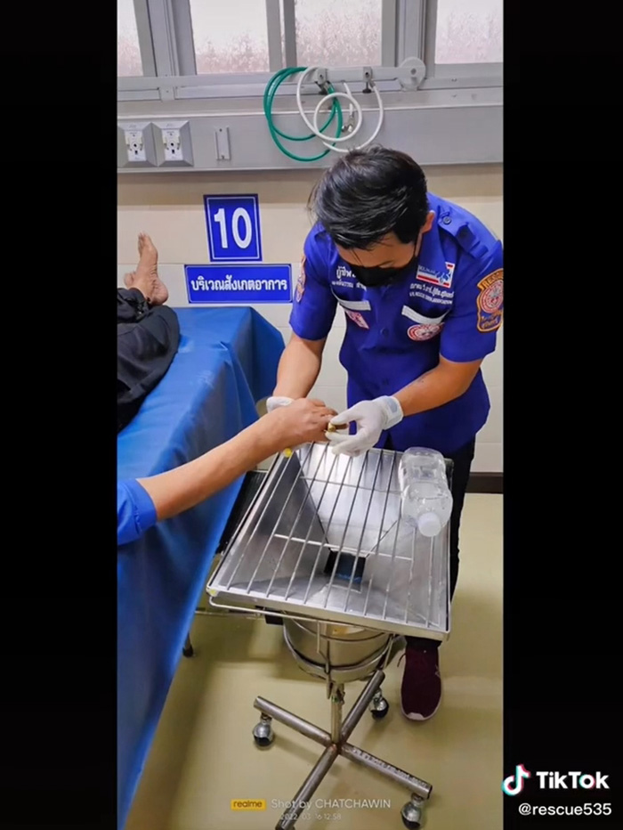 กู้ภัยเผยคลิปนาทีช่วยคนนิ้วกินแหวน