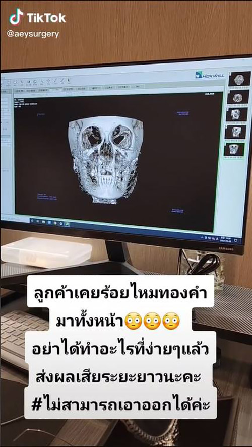 เปิดภาพสแกน 4D ร้อยไหมทองคำทั้งหน้า 