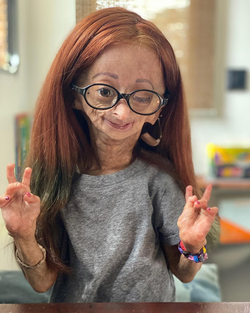 Adalia Rose 