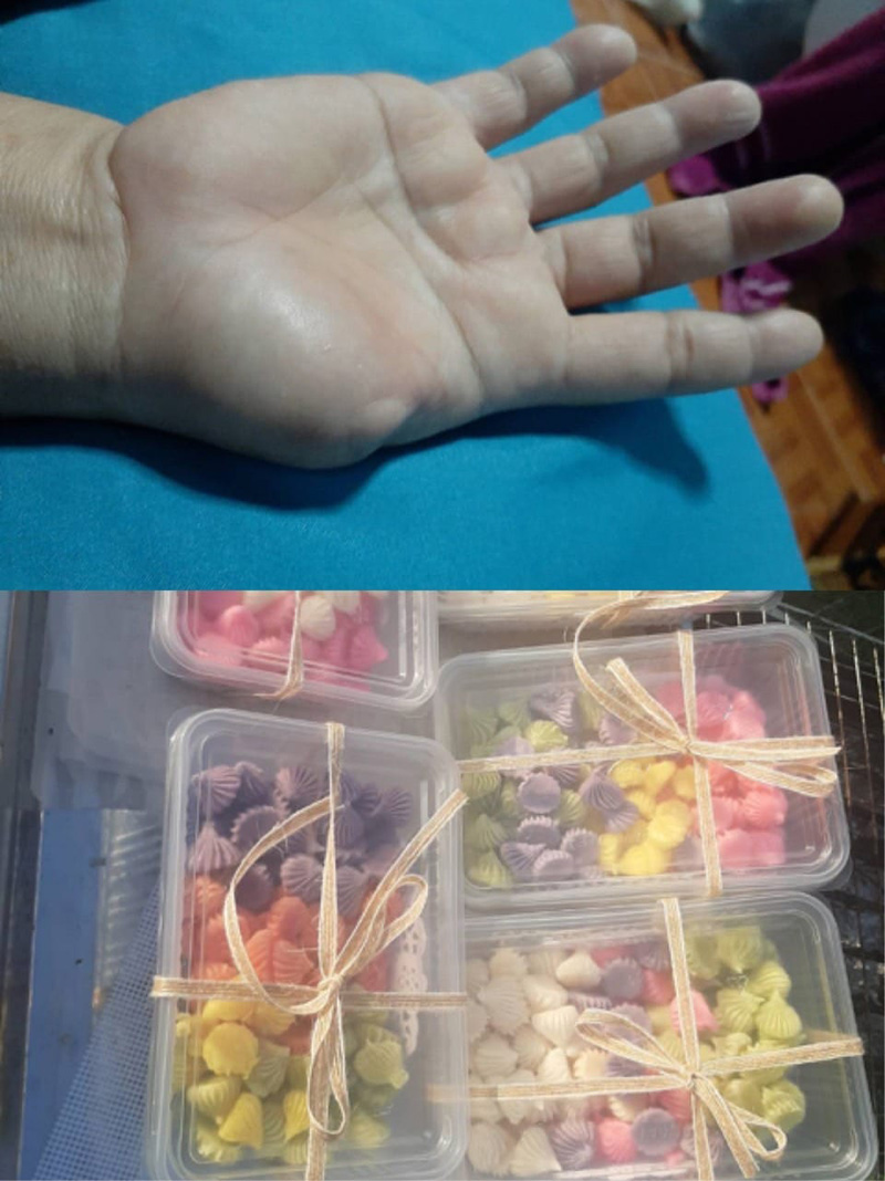 แม่ค้าพิการสู้ชีวิต ตั้งใจทำขนมขาย 