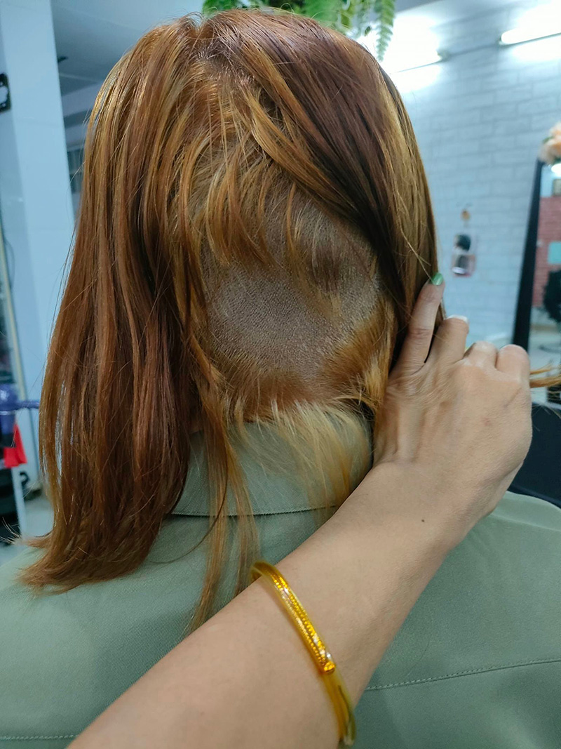 สาวกัดผมเองทำพลาด สภาพร่วงหายเป็นกระจุกครึ่งหัว