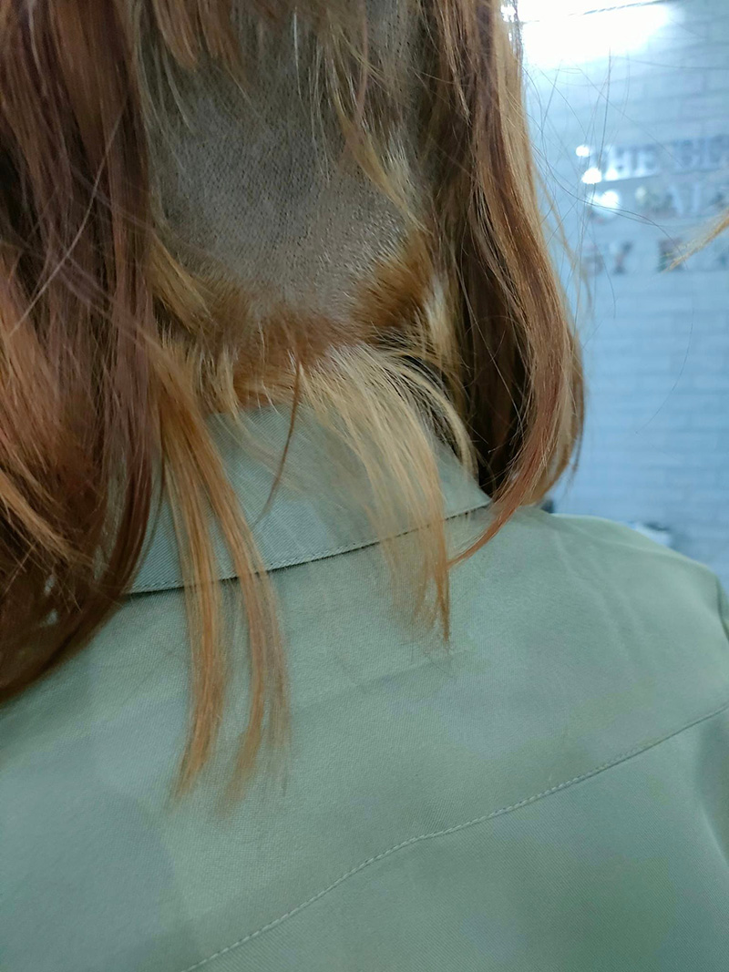 สาวกัดผมเองทำพลาด สภาพร่วงหายเป็นกระจุกครึ่งหัว