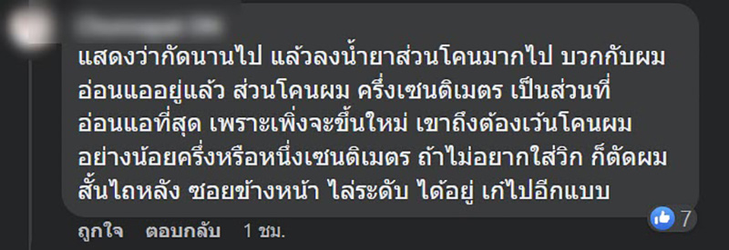 สาวกัดผมเองทำพลาด สภาพร่วงหายเป็นกระจุกครึ่งหัว