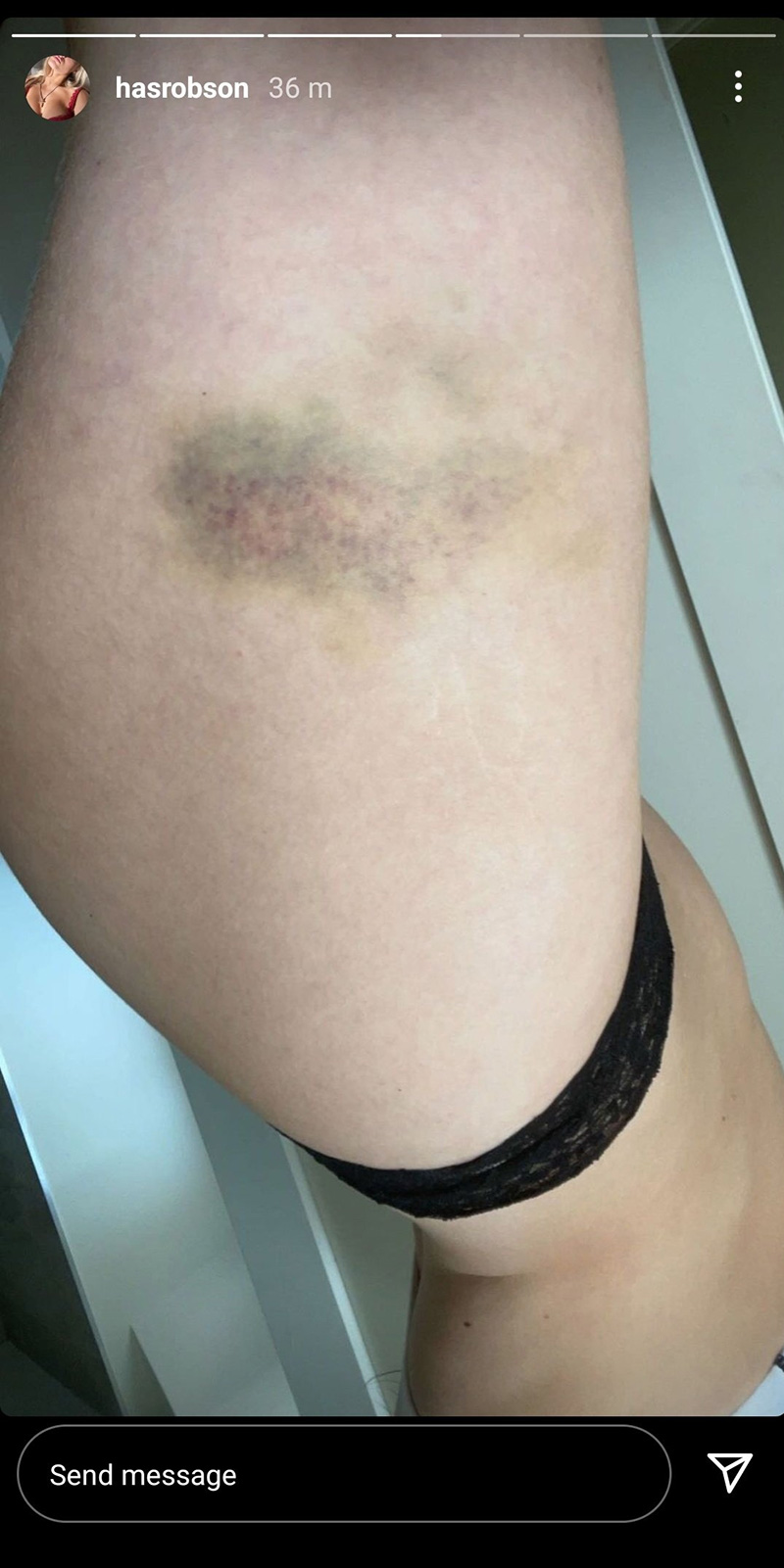 แฮเรียต ร็อบสัน