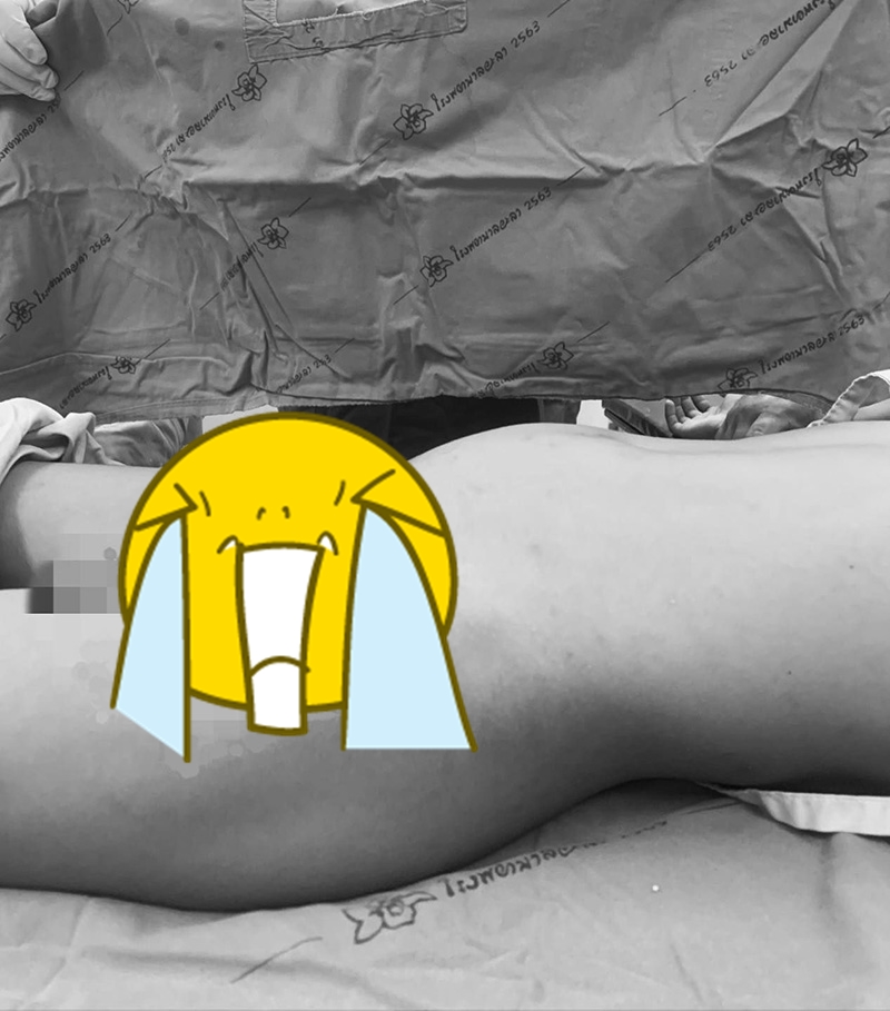 พิธีสุหนัต