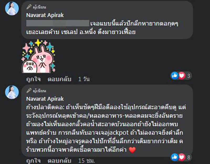 อุทาหรณ์ก้างปลาติดคอ หมอเตือนกลืนข้าวตามเป็นความเชื่อที่ผิด