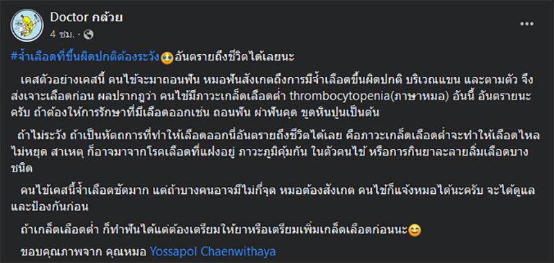  เจอเคสคนไข้มาทำฟัน พบจ้ำเลือดผิดปกติตามตัว ชี้อันตรายถึงชีวิต 